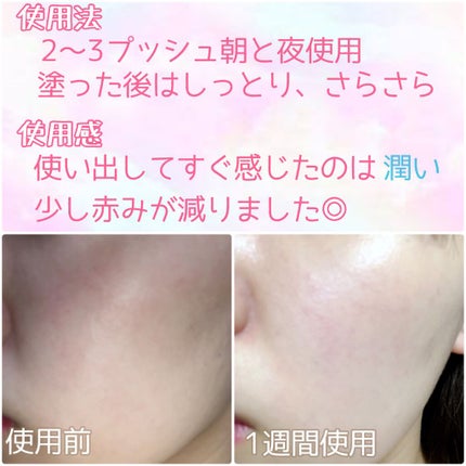 キャビアドットブースター/DEW/ブースター・導入液を使ったクチコミ(2枚目)