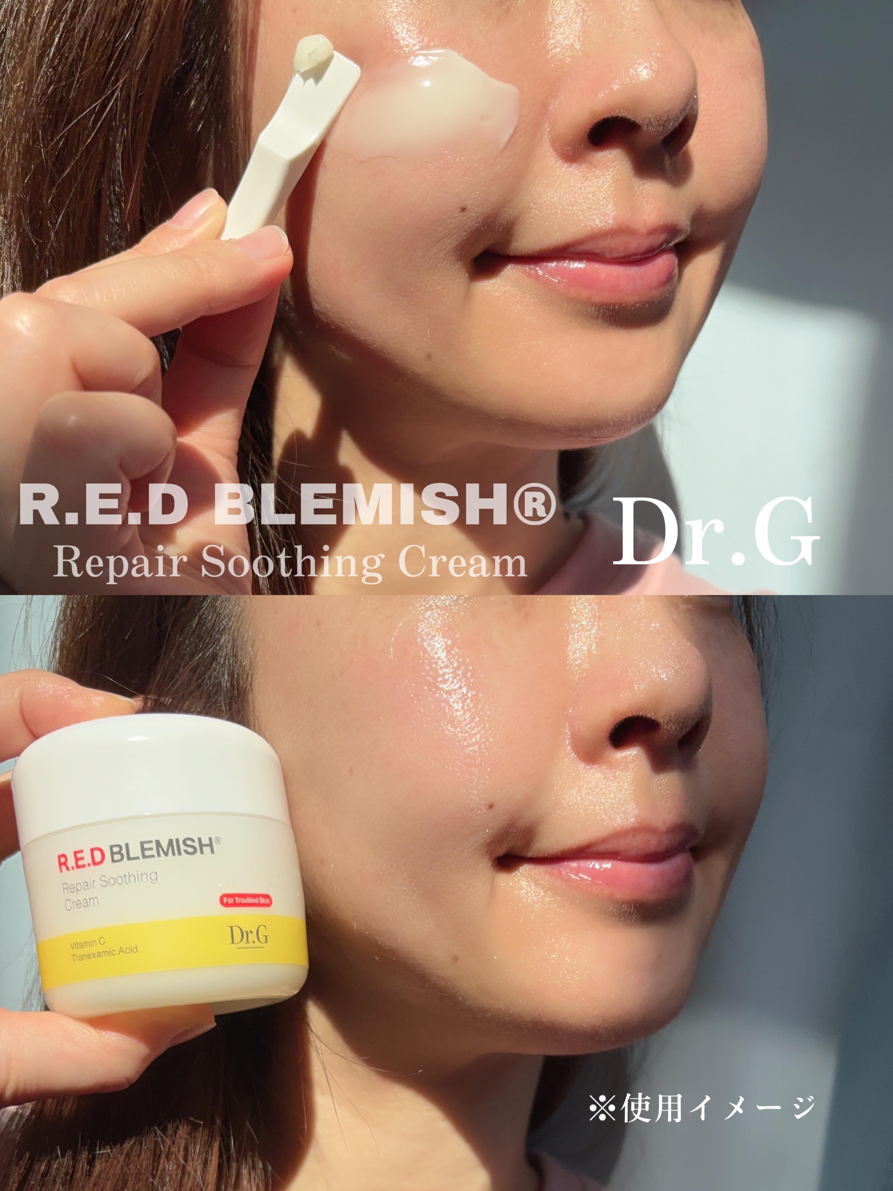 レッドブレミッシュ リペアスージングクリーム/Dr.G/フェイスクリームを使ったクチコミ（3枚目）