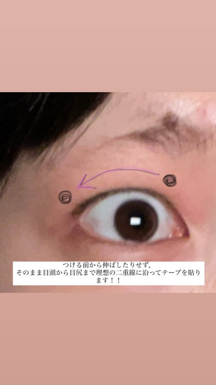 アイテープ(絆創膏タイプ、レギュラー、70枚)/DAISO/二重まぶた用アイテムを使ったクチコミ(3枚目)