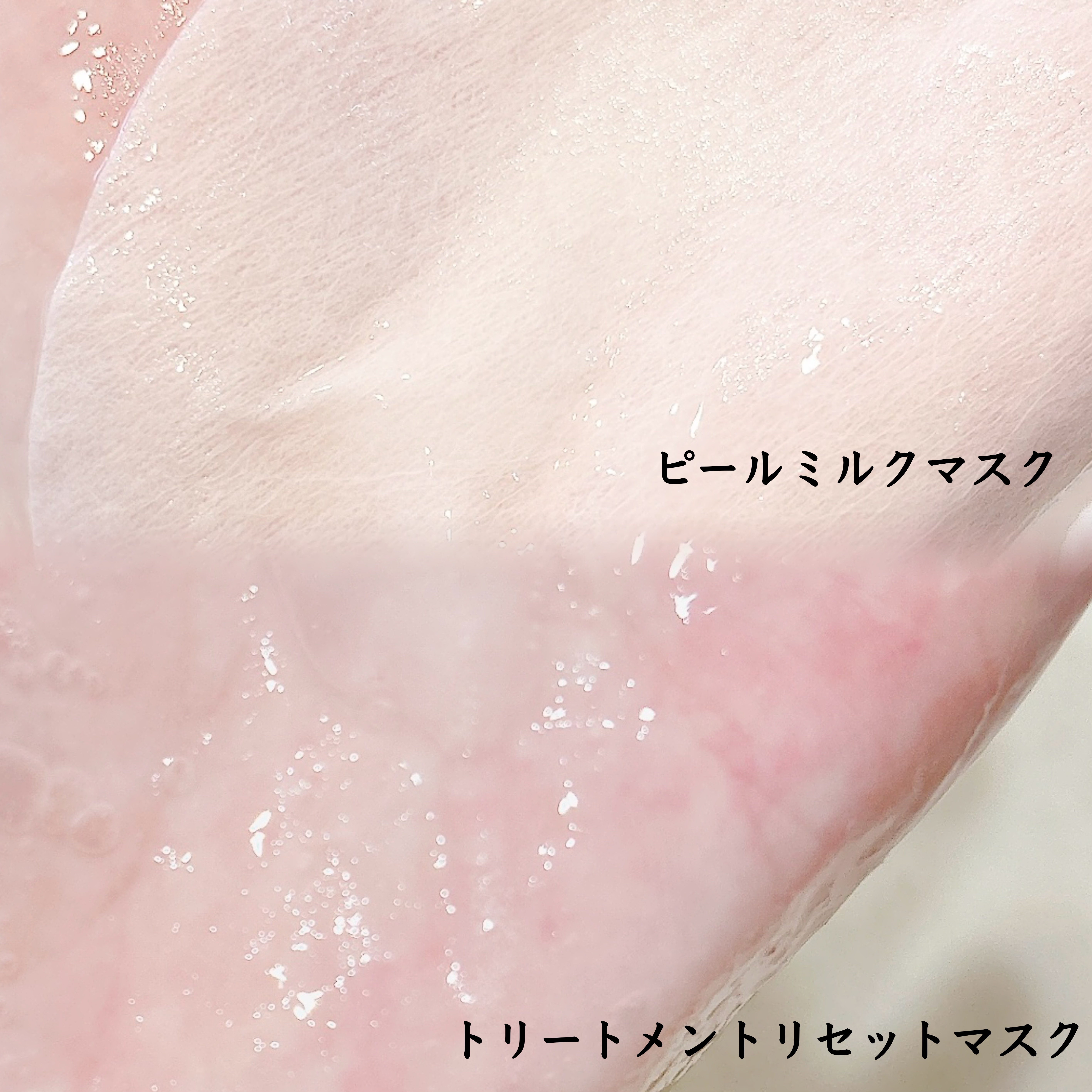 トリートメントリセットマスク/ALFACE+/シートマスク・パックを使ったクチコミ（2枚目）