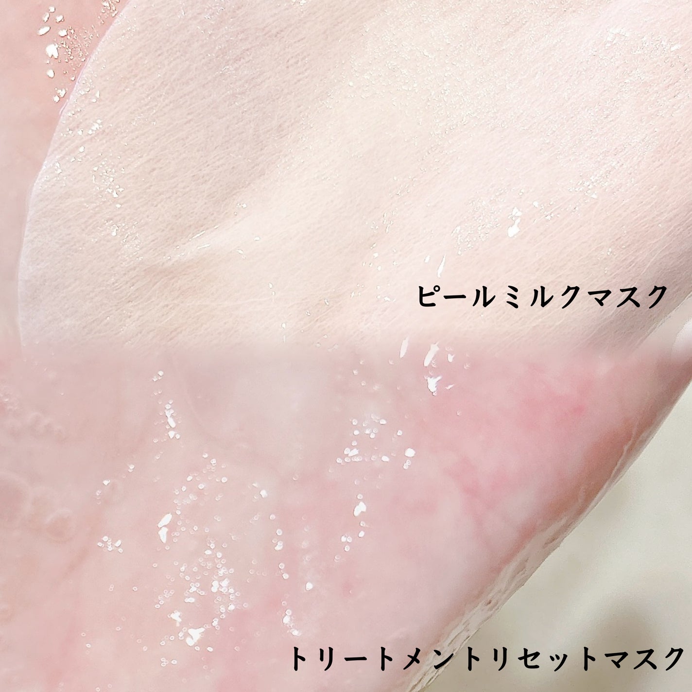 トリートメントリセットマスク/ALFACE+/シートマスク・パックを使ったクチコミ(2枚目)