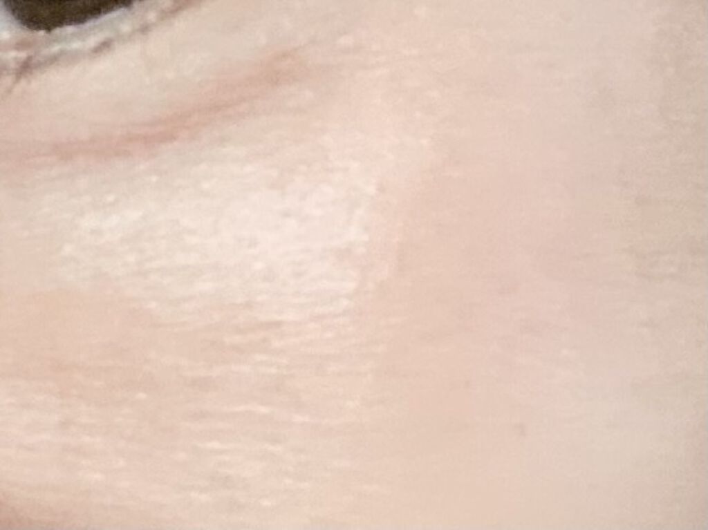 EGF-エクストラエッセンス EX/TBC/美容液を使ったクチコミ（2枚目）