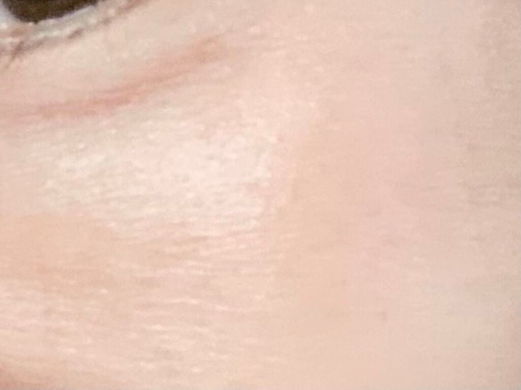 EGF-エクストラエッセンス EX/TBC/美容液を使ったクチコミ(2枚目)