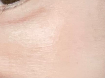 EGF-エクストラエッセンス EX/TBC/美容液を使ったクチコミ(2枚目)