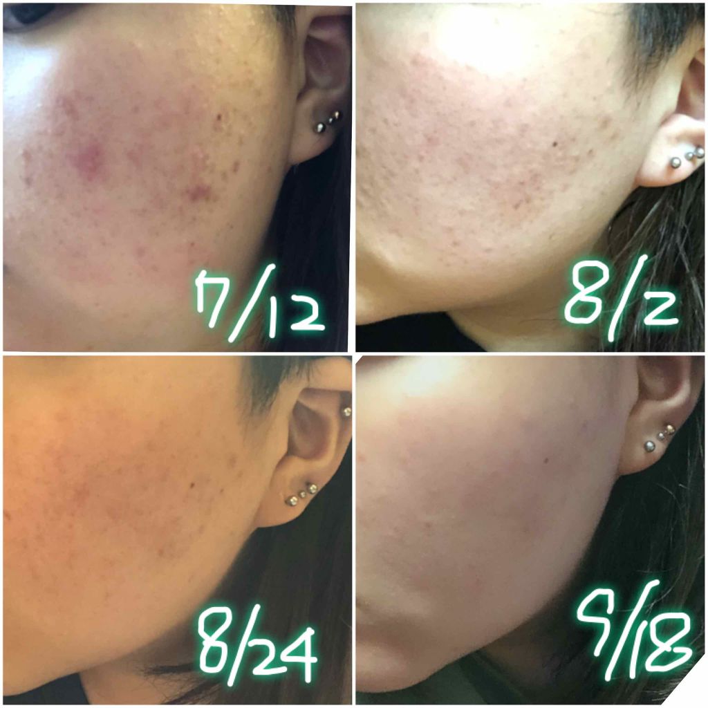 アルガンクリーム/ナイアード/ボディクリームを使ったクチコミ（1枚目）