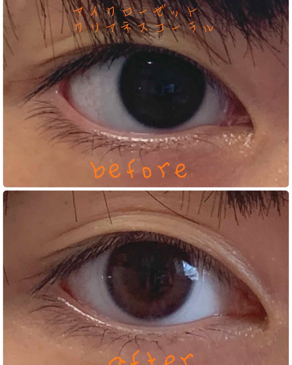 eye closet １day SweetSeries "Girly"（アイクローゼットワンデースウィートシリーズ ガーリー）/EYE CLOSET/ワンデー（１DAY）カラコンを使ったクチコミ（3枚目）