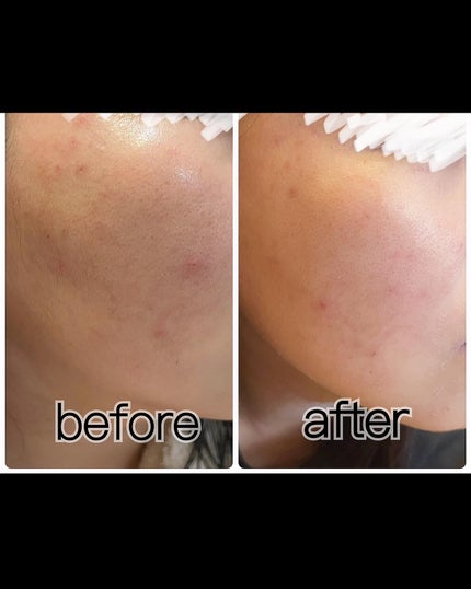 ホワイト クレイ酵素クレンザー /SKIN SIGNAL/洗顔パウダーを使ったクチコミ(5枚目)