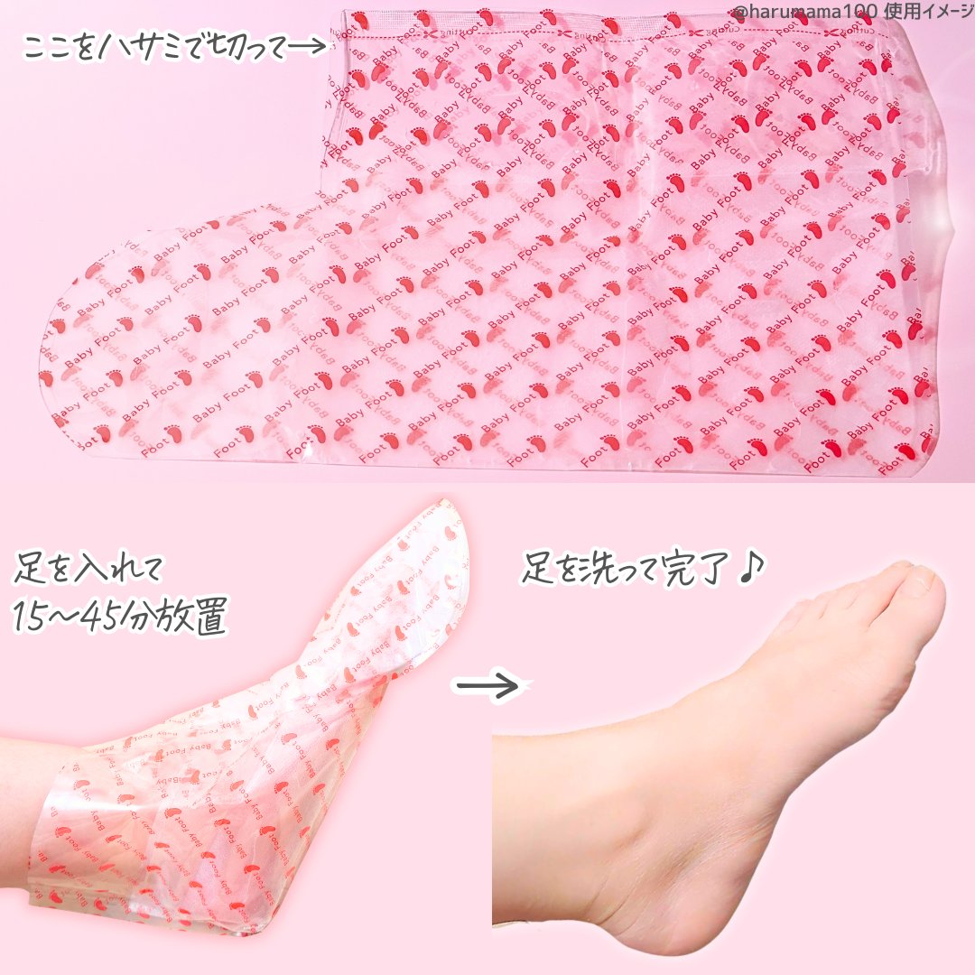 ベビーフット 重曹殺菌消毒洗浄剤/ベビーフット/レッグ・フットケアを使ったクチコミ（3枚目）