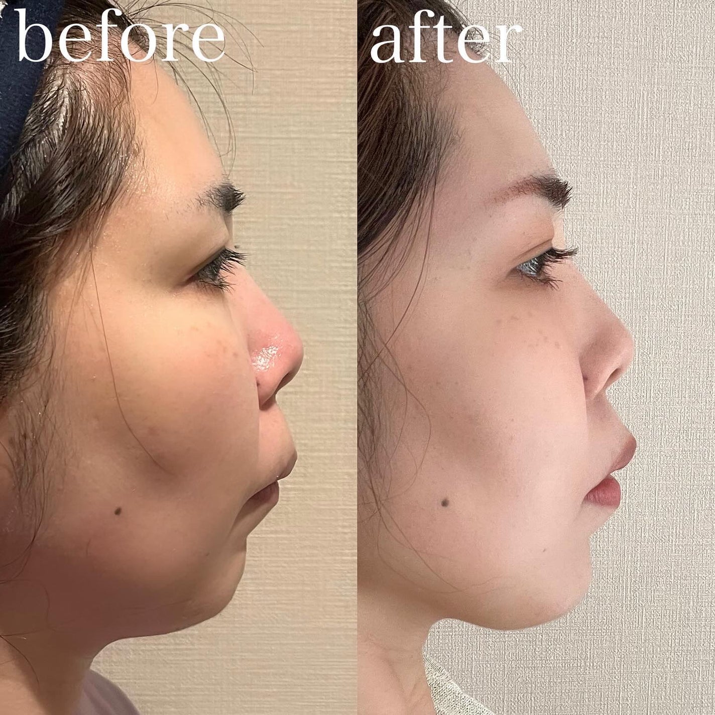 manað«§ãããã©ã§æ¥œãã倧人ã®çŸå®¹/ã³ã¹ã¡ on LIPS ããããã¯ã¹æã£ãŠããã//念é¡ã®ãããã¯ã¹æã£ãŠããããðé¡ã®..ãïŒ3æç®ïŒ