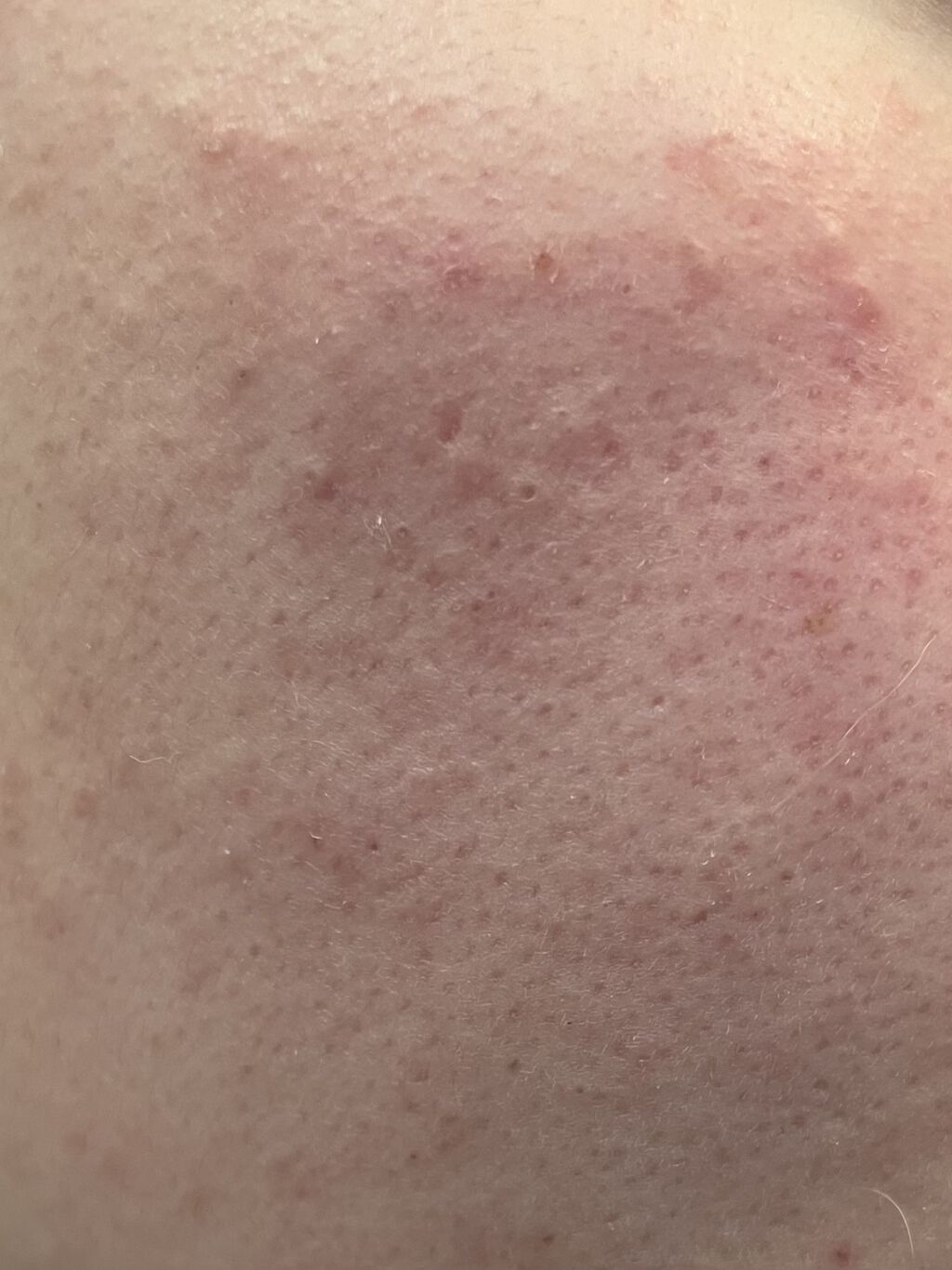 BQ ウォッシングフォーム/YOAN/洗顔フォームを使ったクチコミ（2枚目）