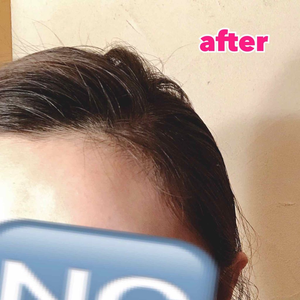 まとめ髪スティック スーパーホールド/マトメージュ/ヘアワックス・クリームを使ったクチコミ(3枚目)