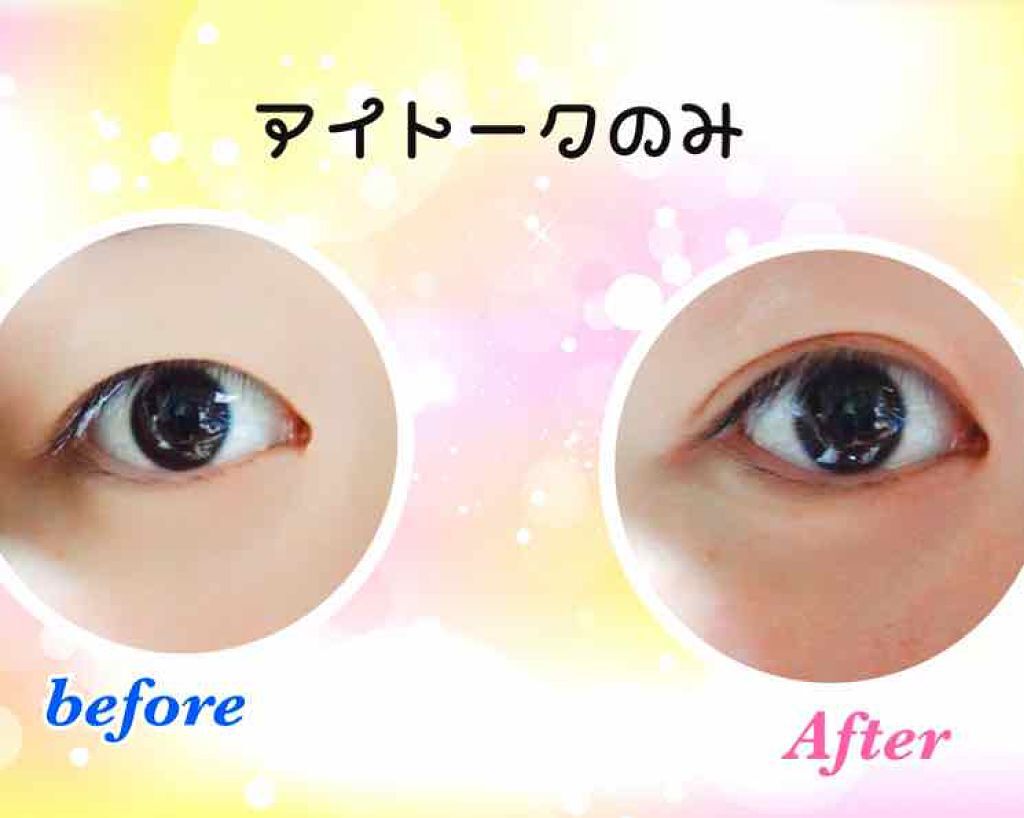 アイトーク/アイトーク/二重まぶた用アイテムを使ったクチコミ(2枚目)