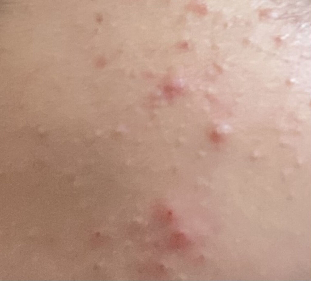 前髪クリップ/DAISO/ヘアアクセサリーを使ったクチコミ（3枚目）