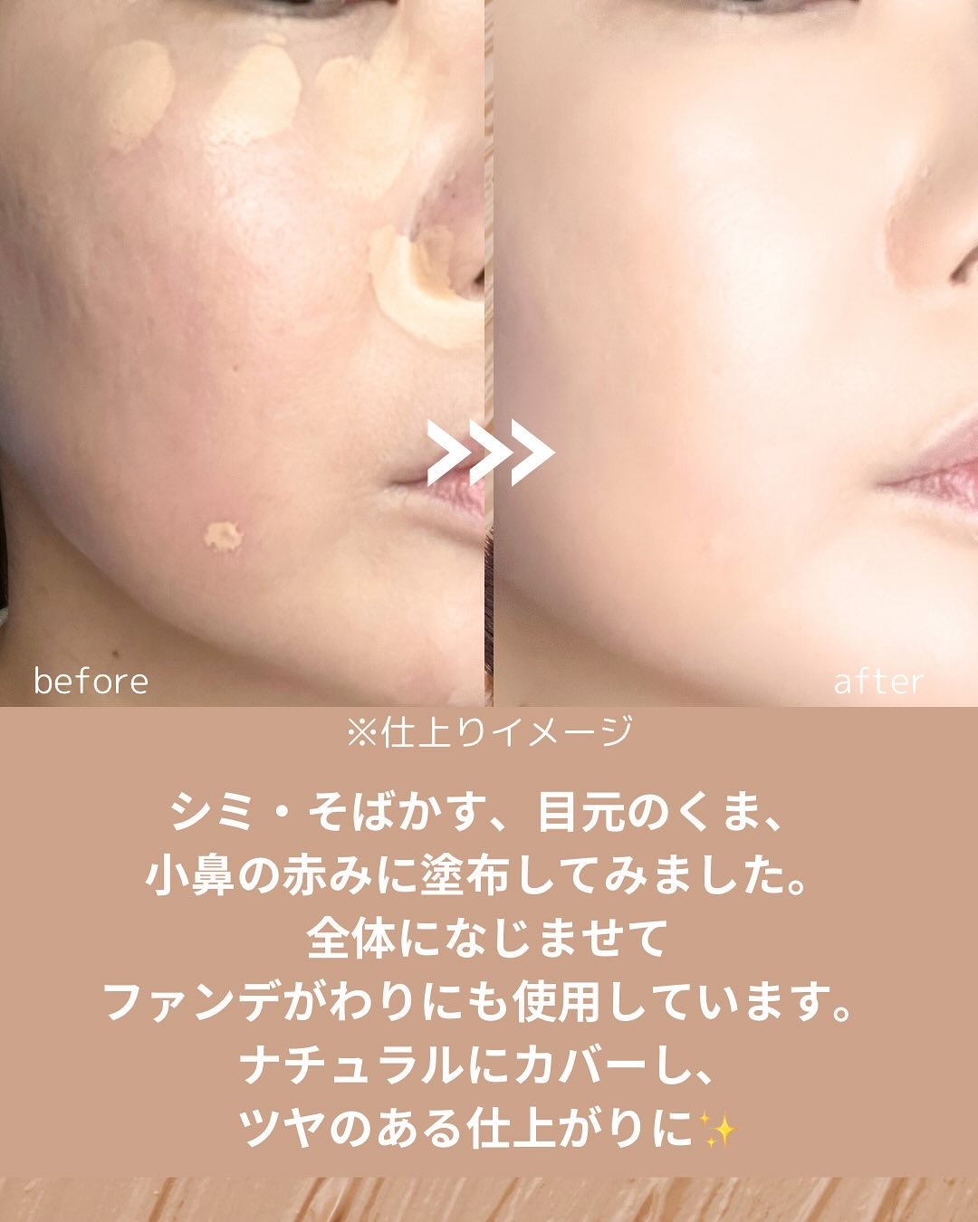 ダーマシンコンシーラー/23years old/リキッドコンシーラーを使ったクチコミ（3枚目）