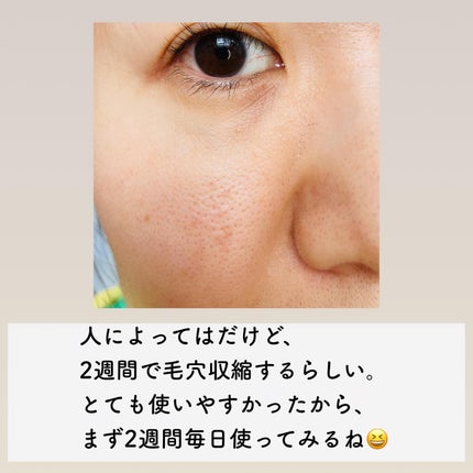 ホーリーバジルスキンコントローラー/FLOUN/化粧水を使ったクチコミ(5枚目)