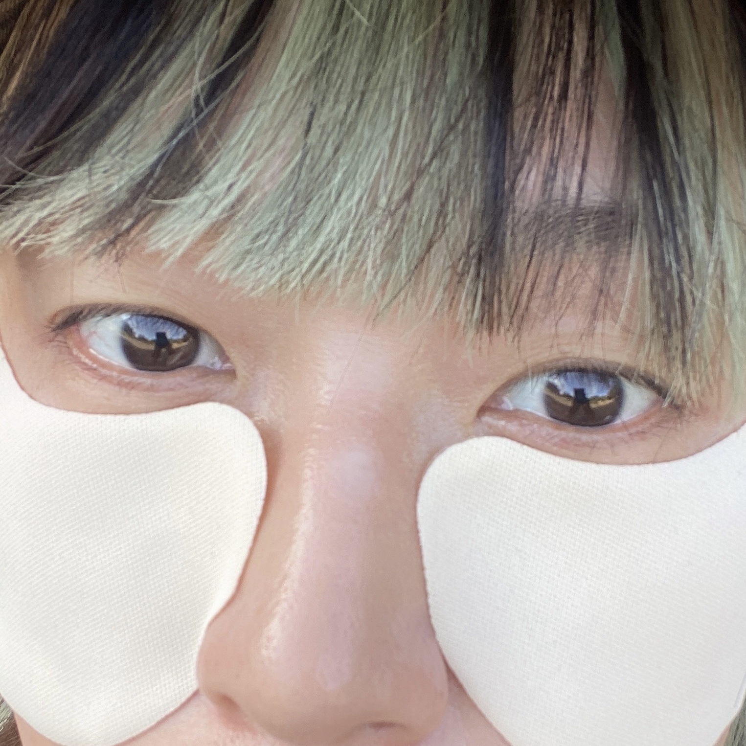 ブレミッシュショット アウトドアサンパッチ/AMPLE:N/その他スキンケアを使ったクチコミ（2枚目）