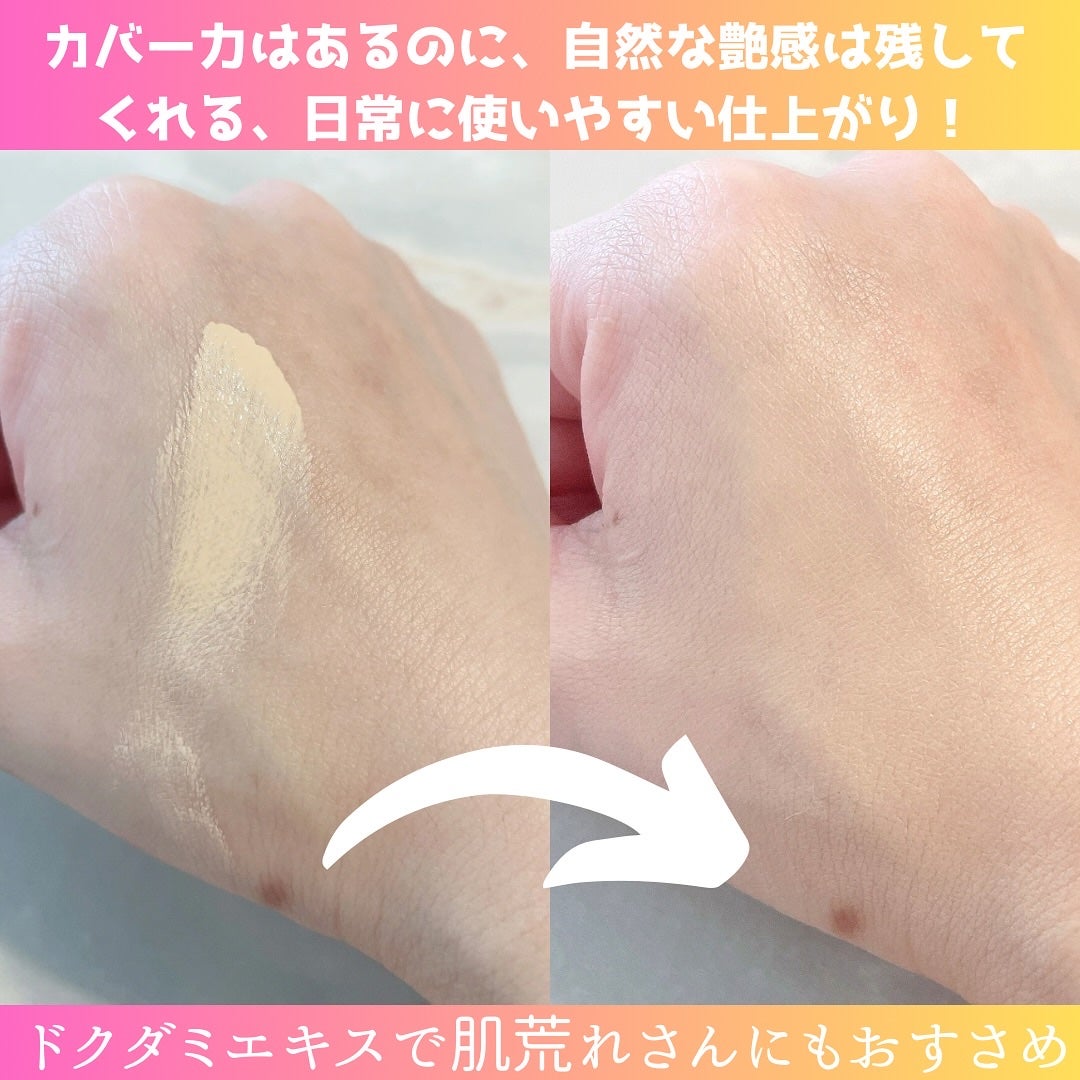 ダーマシンコンシーラー/23years old/リキッドコンシーラーを使ったクチコミ(3枚目)