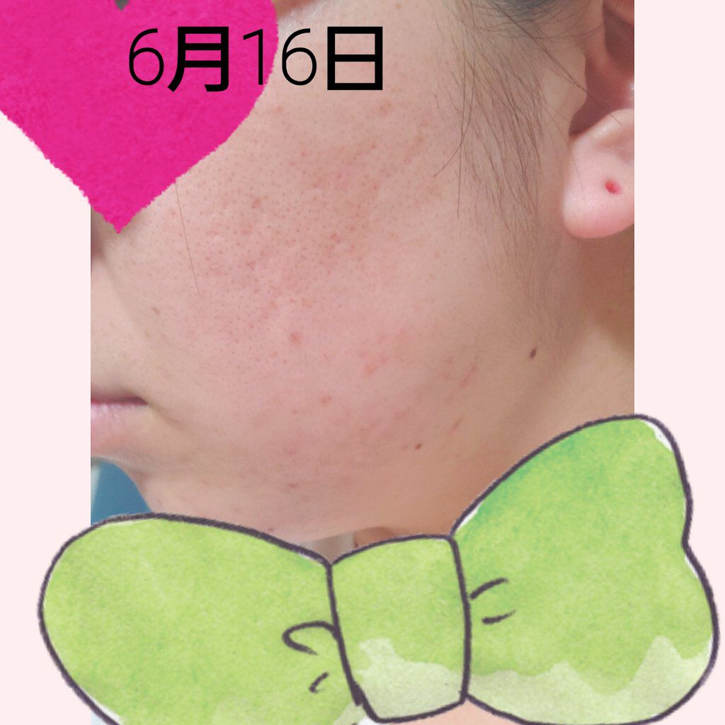 ハトムギ保湿ジェル(ナチュリエ スキンコンディショニングジェル)/ナチュリエ/美容液を使ったクチコミ（3枚目）