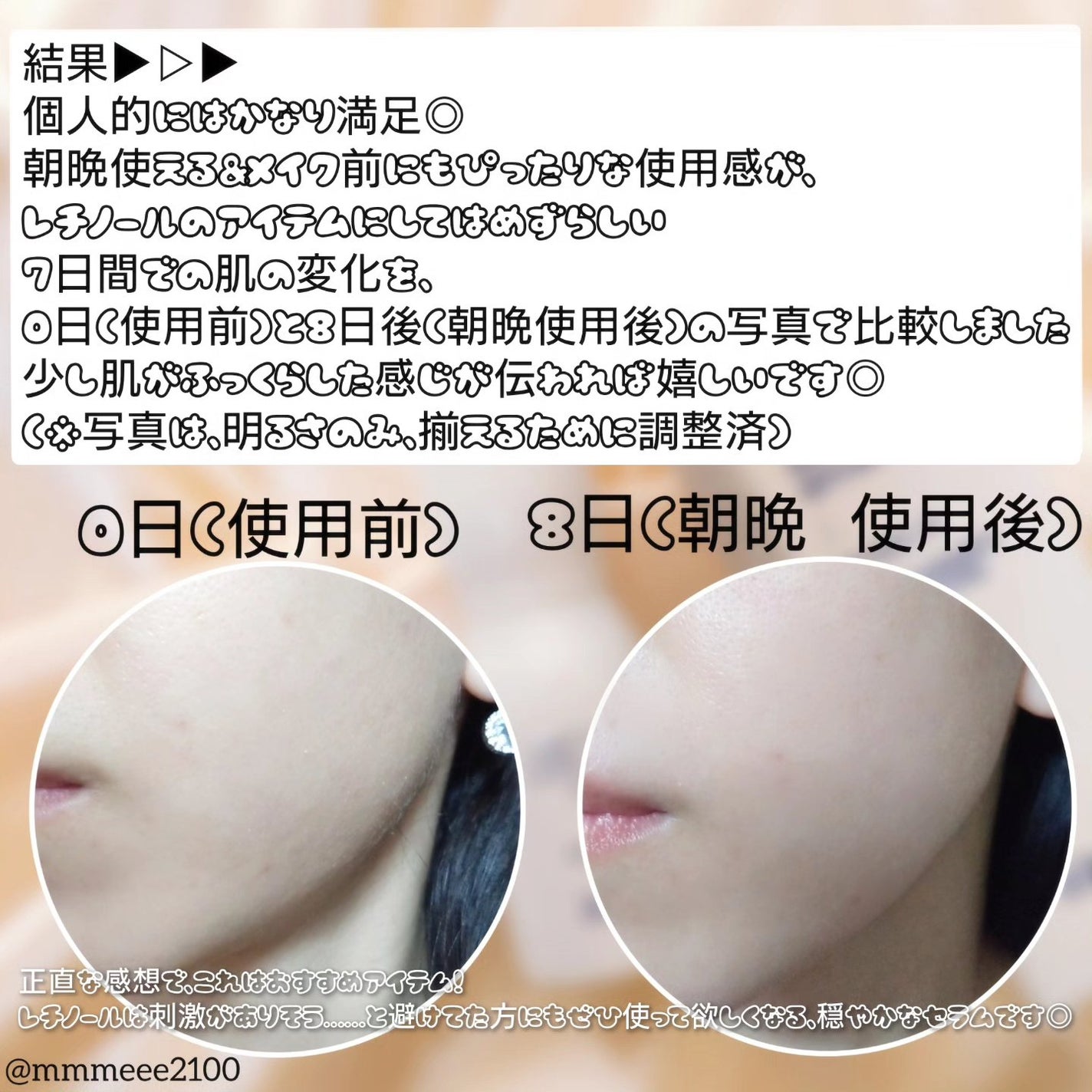 レチノール スーパーバウンス セラム/IOPE/美容液を使ったクチコミ(4枚目)