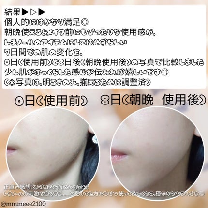 レチノール スーパーバウンス セラム/IOPE/美容液を使ったクチコミ(4枚目)