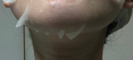 ダーマレーザー ナイアシンアミド+レチノール/クオリティファースト/シートマスク・パックを使ったクチコミ(6枚目)