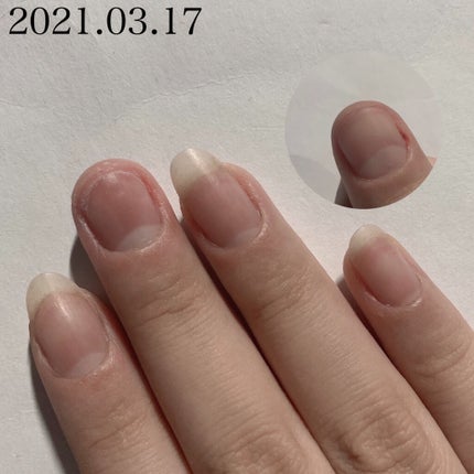 ネイルオイル/ベリンダ/ネイルオイル・トリートメントを使ったクチコミ(7枚目)