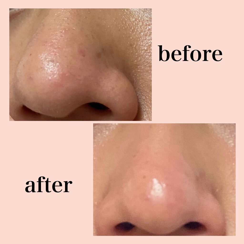 化粧水 しっとりタイプ/ちふれ/化粧水を使ったクチコミ（3枚目）