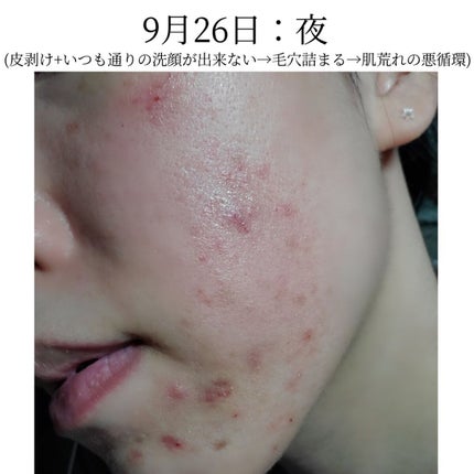 スキンプロテクトベース<皮脂くずれ防止> 超オイリー肌用/プリマヴィスタ/化粧下地を使ったクチコミ(3枚目)