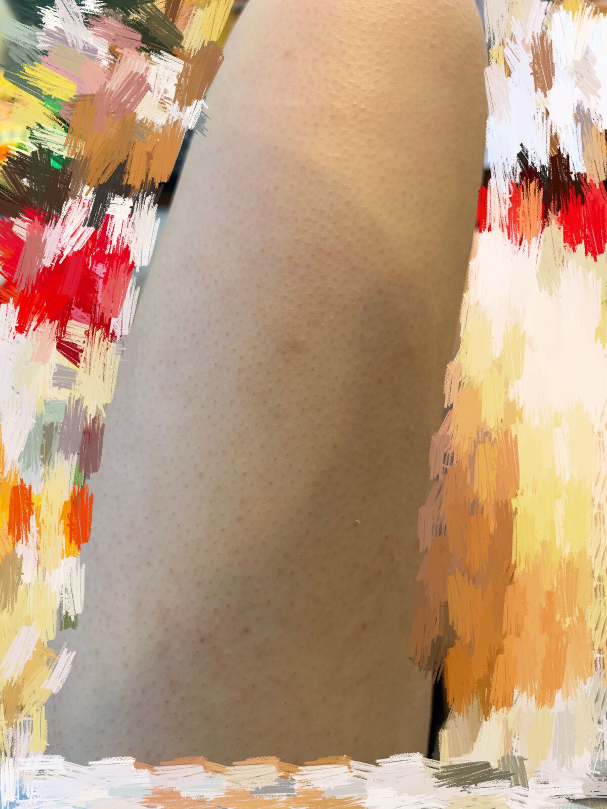 ケアノキュア（医薬品）/小林製薬/その他を使ったクチコミ（2枚目）