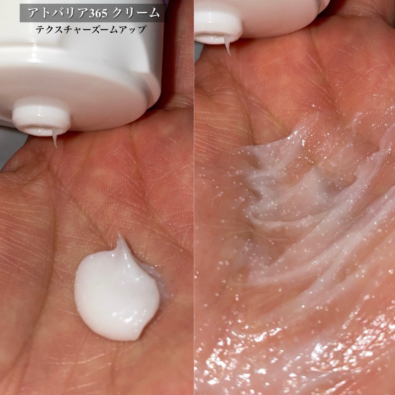 アトバリア365クリーム/AESTURA/フェイスクリームを使ったクチコミ(4枚目)