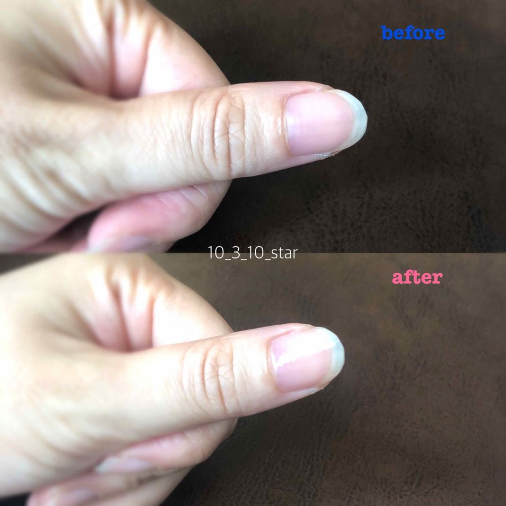 ビューティー ネイル ケア&コート/キャンメイク/ネイルオイル・トリートメントを使ったクチコミ(3枚目)