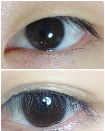 【旧品】オリシキ アイリッドスキンフィルム/D-UP/二重まぶた用アイテムを使ったクチコミ(4枚目)