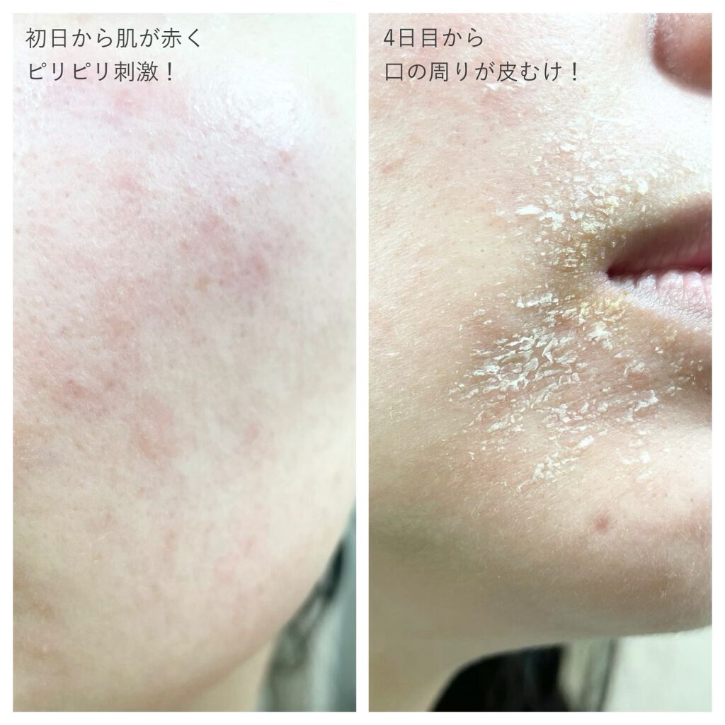 ZO Skin Healthのスキンケア・基礎化粧品 ミラミン&バランサー ZO Skin Healthのスキンケア・基礎化粧品 ミラミン&バランサー