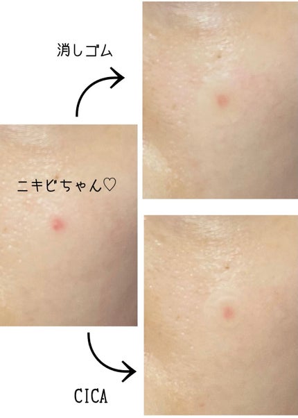 エラバンドパッチ/ElaBAND/その他を使ったクチコミ(3枚目)