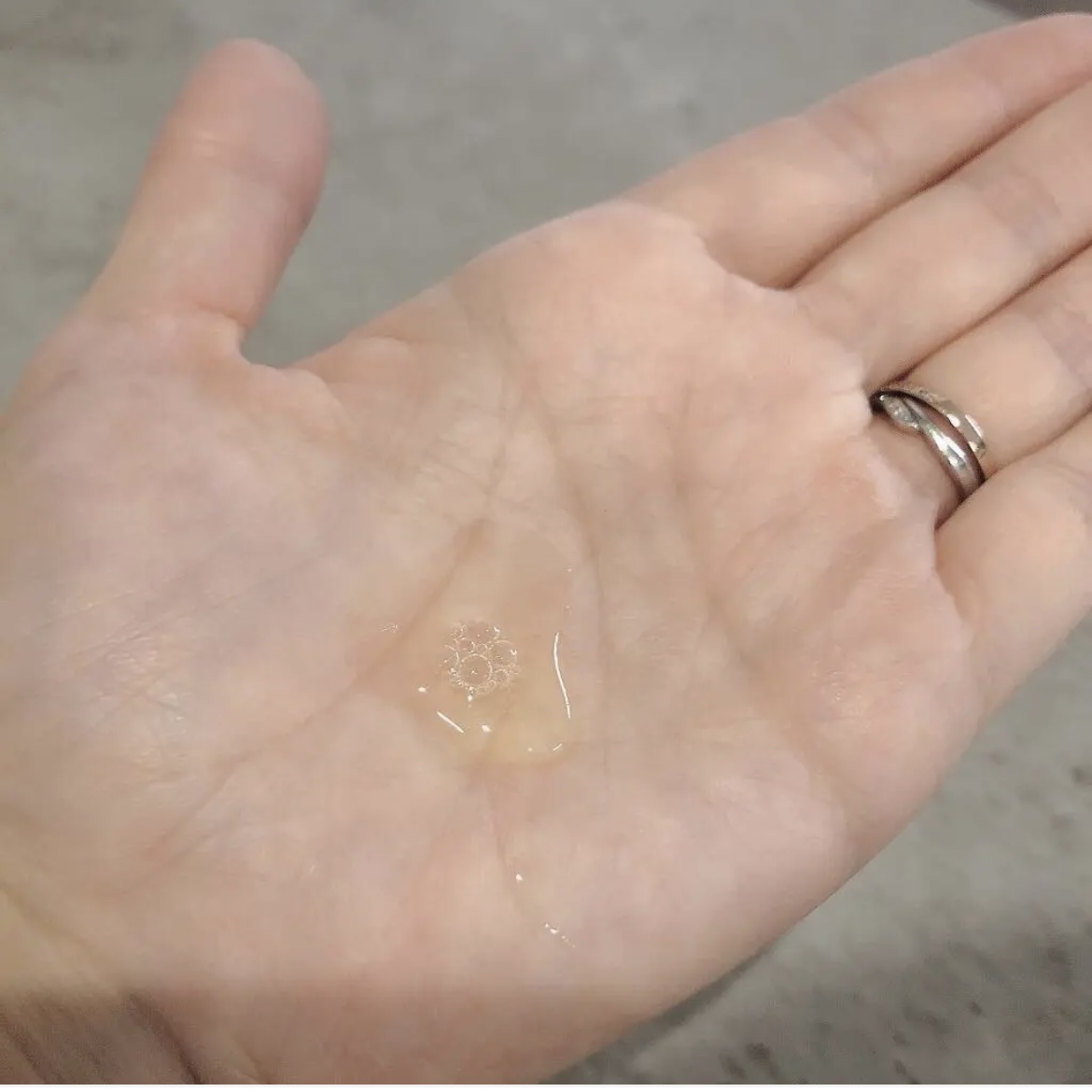 ガラクトミセスピュアビタミンCグロートナー/SOME BY MI/化粧水を使ったクチコミ（3枚目）