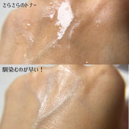 ピンクティーツリートナー/APLIN/化粧水を使ったクチコミ(4枚目)