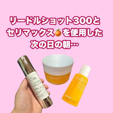 薬用しみ対策 美白乳液【医薬部外品】/メラノCC/乳液を使ったクチコミ（1枚目）