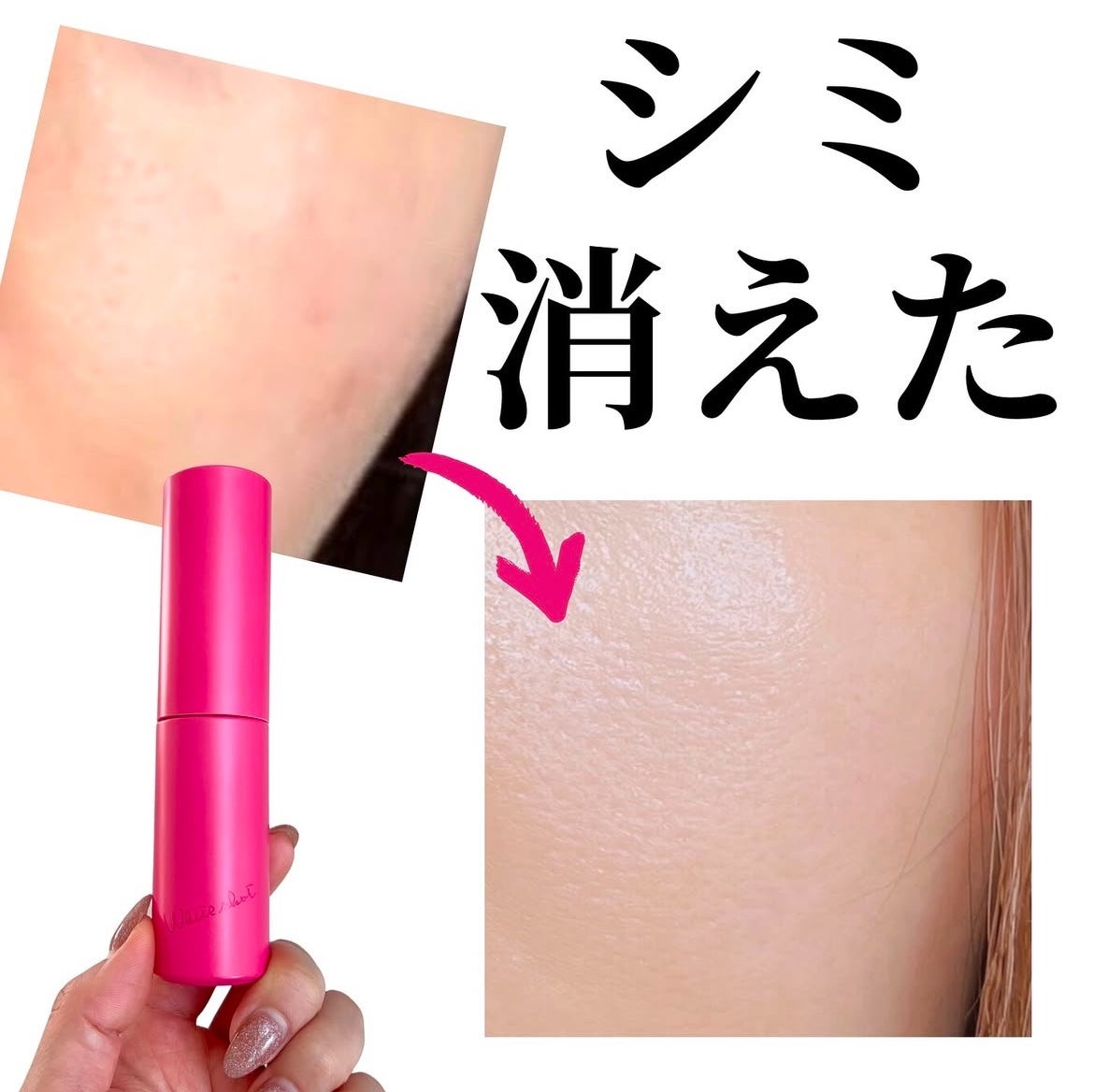 ホワイトショット フェイシャルセラム/POLA/美容液を使ったクチコミ(1枚目)