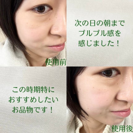 バランシング シカ ブレミッシュ クリーム/Roume/フェイスクリームを使ったクチコミ(6枚目)