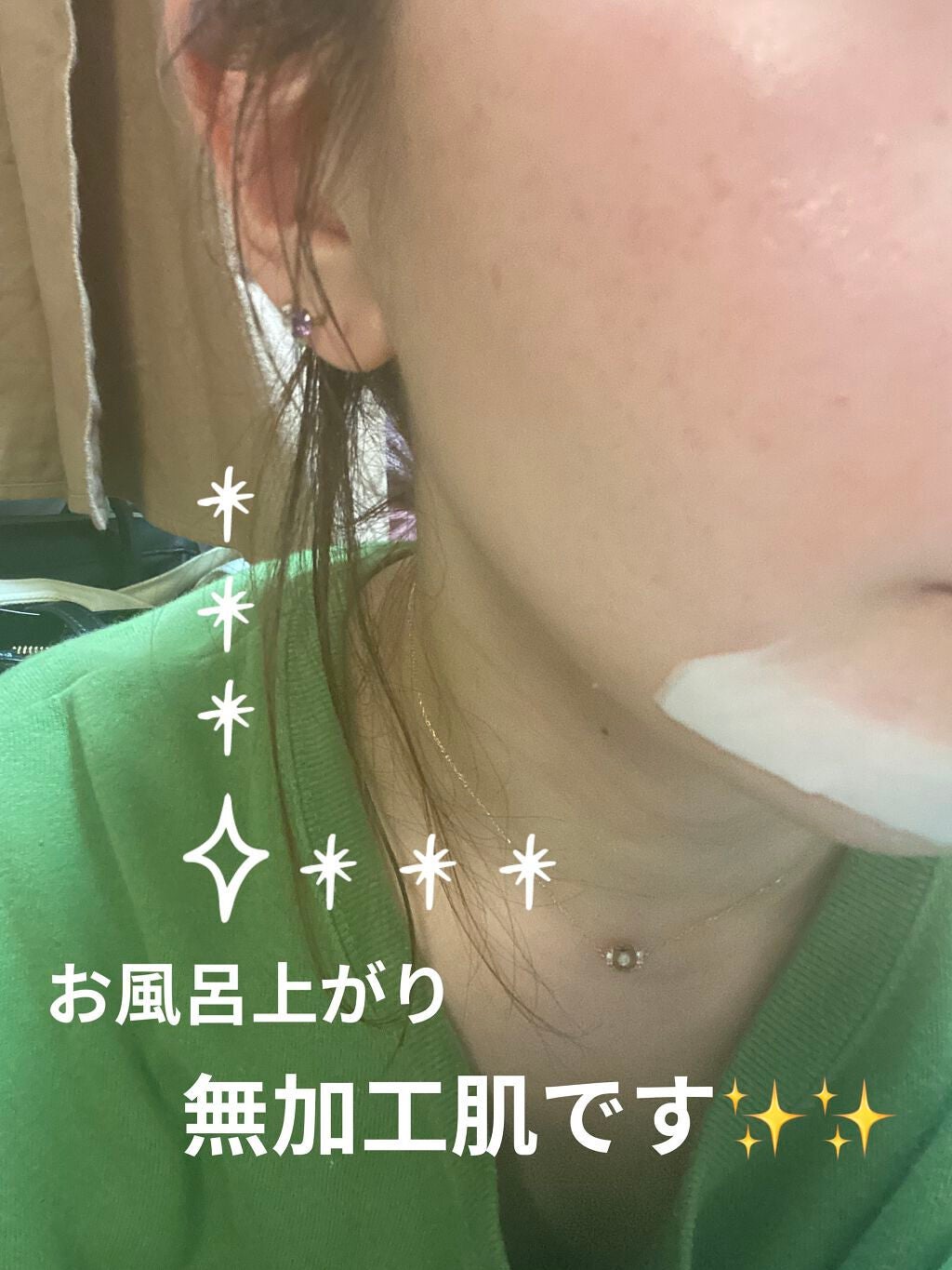 オードムーゲ 薬用ローション(ふきとり化粧水)/オードムーゲ/拭き取り化粧水を使ったクチコミ(1枚目)