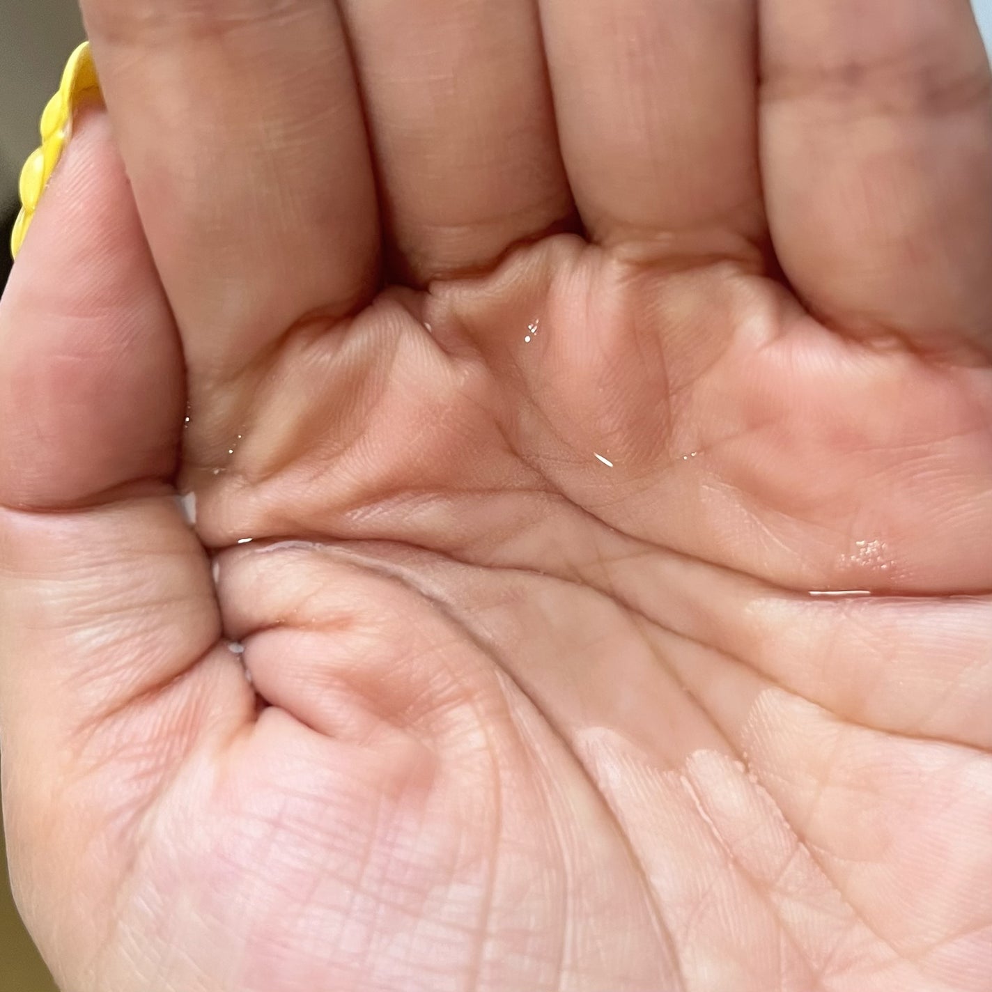 ヘパトリート 薬用保湿化粧水/ゼトックスタイル/化粧水を使ったクチコミ(2枚目)