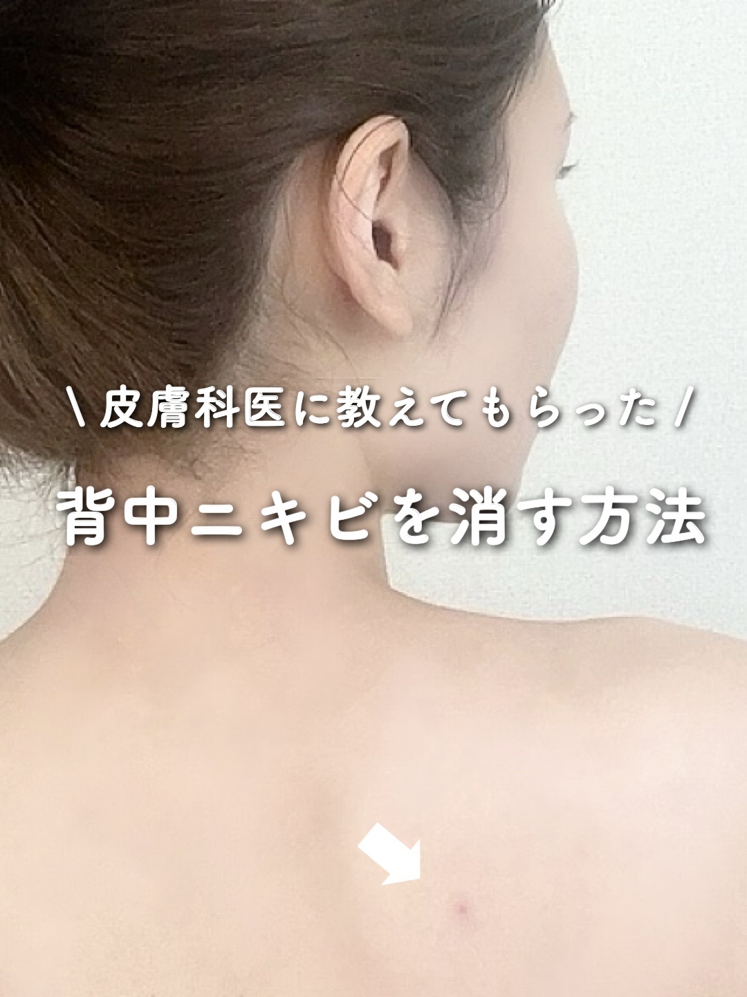 セタフィル モイスチャライジングローション/セタフィル/ボディローションを使ったクチコミ（1枚目）