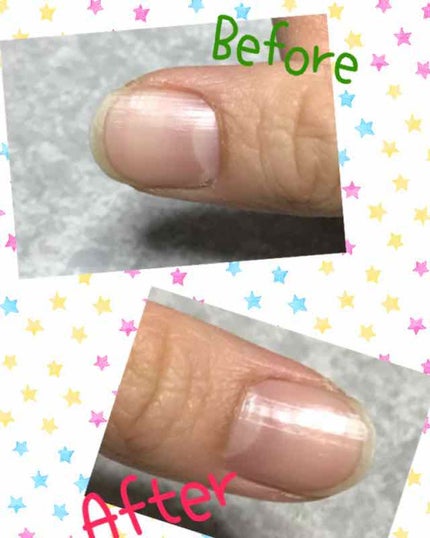 エテュセ クイックケアコート/ettusais/ネイルオイル・トリートメントを使ったクチコミ(2枚目)