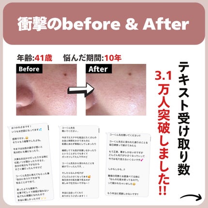 あなたの肌に合ったスキンケア💐コーくん先生 on LIPS 「【3.1万人が効果を実感】エグいほど毛穴が消える神スキンケア...」(7枚目)