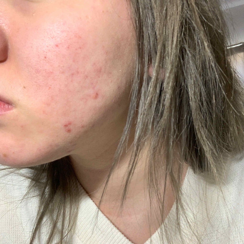 7 day Special Set プログラム3/b.glen/トライアルキットを使ったクチコミ(2枚目)