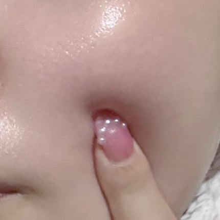 アゼペア 美容液/ネイチャーリパブリック/美容液を使ったクチコミ(4枚目)