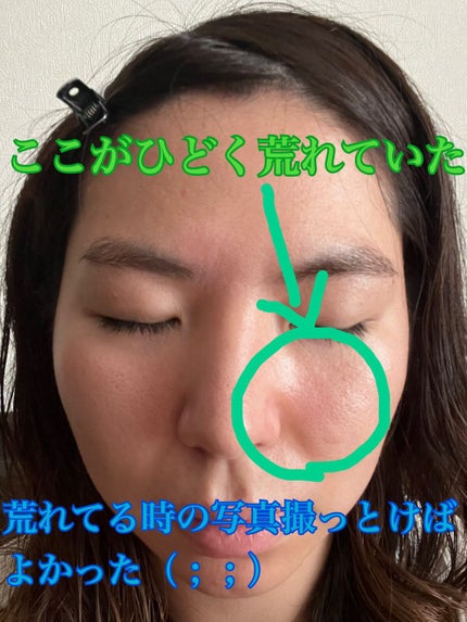 スキンメインテナイザー ST W2/リサージ/化粧水を使ったクチコミ(2枚目)