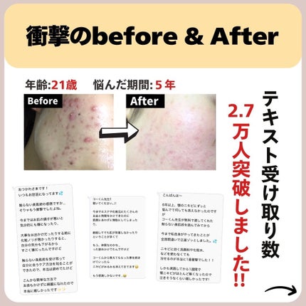 あなたの肌に合ったスキンケア💐コーくん先生 on LIPS 「【9割が知らない】ツヤモテ肌爆速で叶える裏技...あなたの毛穴..」(8枚目)