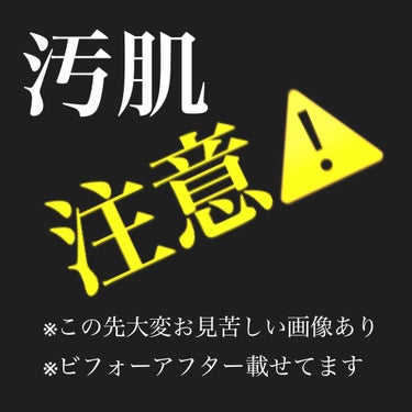 毛穴崩れ防止下地 GS/毛穴パテ職人/化粧下地を使ったクチコミ（1枚目）