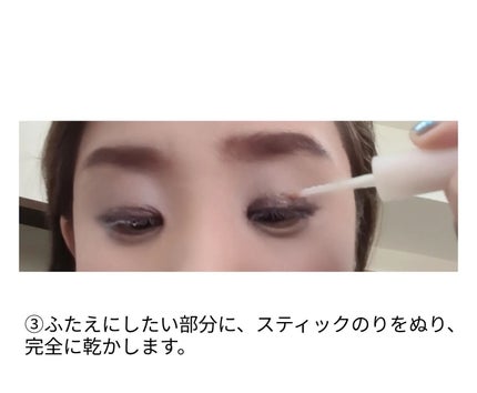 メザイク イージークリア 接着クリアタイプ/メザイク/二重まぶた用アイテムを使ったクチコミ(5枚目)